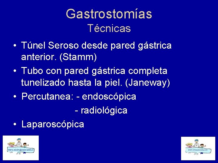 Gastrostomías Técnicas • Túnel Seroso desde pared gástrica anterior. (Stamm) • Tubo con pared