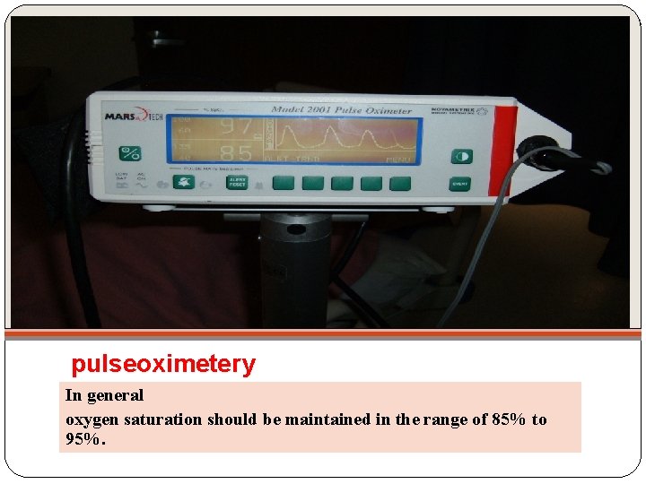 pulseoximetery In general oxygen saturation should be maintained in the range of 85% to