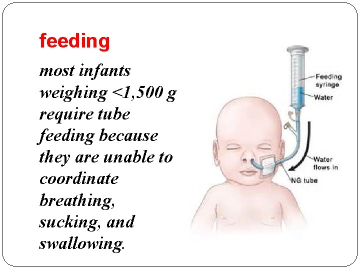 feeding most infants weighing <1, 500 g require tube feeding because they are unable