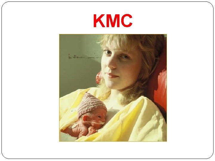 KMC 