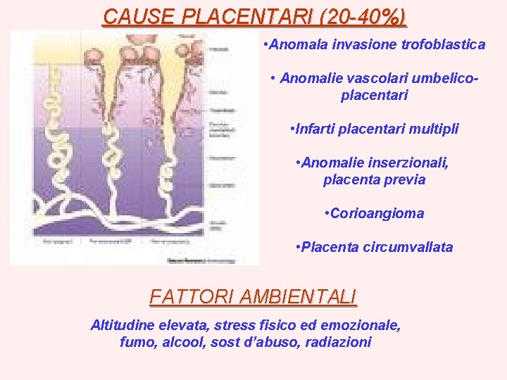 CAUSE PLACENTARI (20 -40%) • Anomala invasione trofoblastica • Anomalie vascolari umbelicoplacentari • Infarti