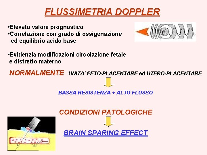 FLUSSIMETRIA DOPPLER • Elevato valore prognostico • Correlazione con grado di ossigenazione ed equilibrio