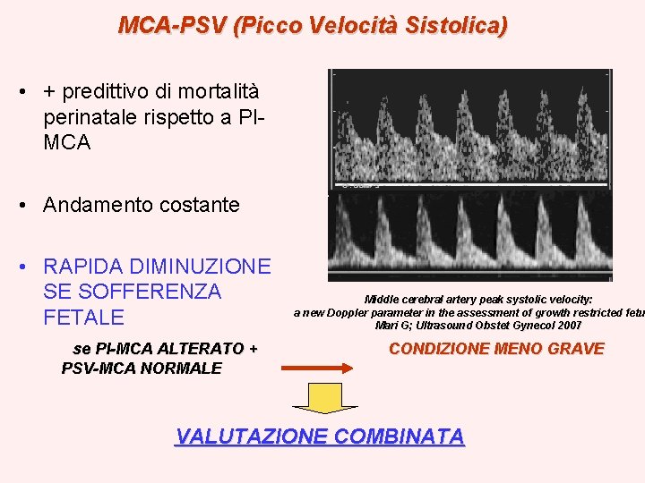 MCA-PSV (Picco Velocità Sistolica) • + predittivo di mortalità perinatale rispetto a PIMCA •