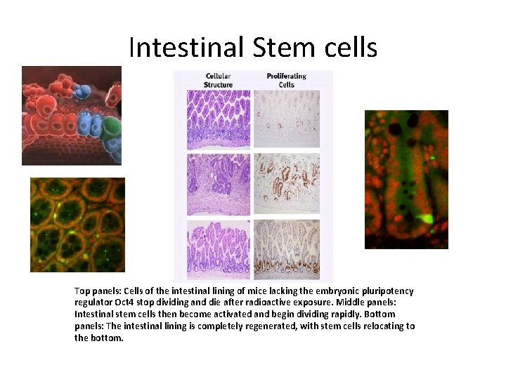 Intestinal Stem cells Top panels: Cells of the intestinal lining of mice lacking the