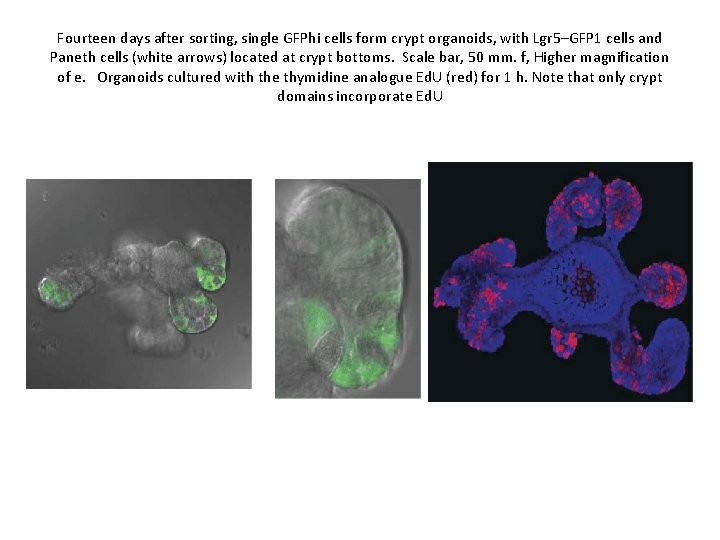 Fourteen days after sorting, single GFPhi cells form crypt organoids, with Lgr 5–GFP 1