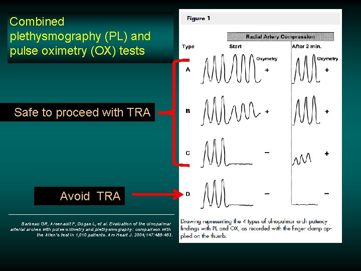 Combined plethysmography (PL) and pulse oximetry (OX) tests Safe to proceed with TRA Avoid