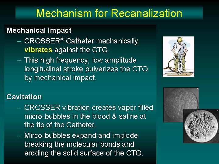 Mechanism for Recanalization Mechanical Impact – CROSSER® Catheter mechanically vibrates against the CTO. –