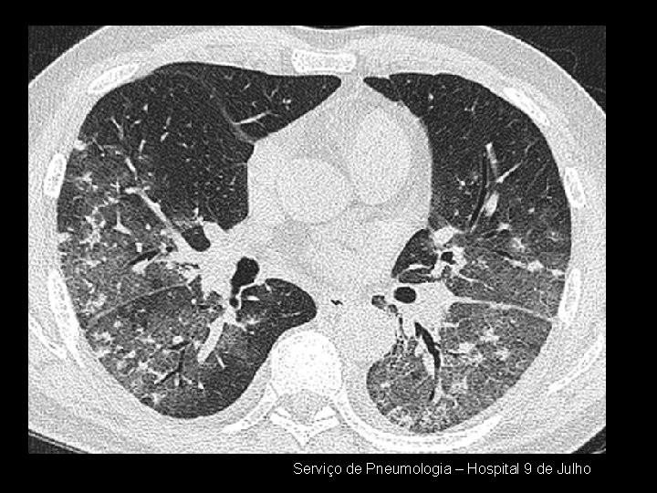 Serviço de Pneumologia – Hospital 9 de Julho 