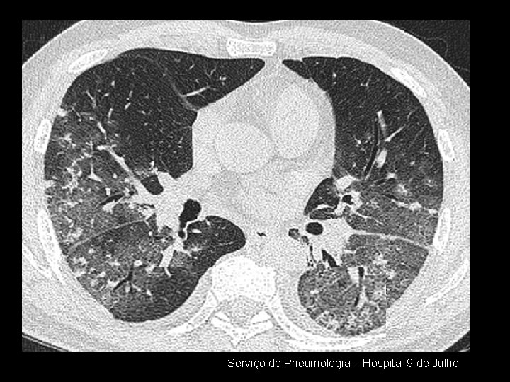 Serviço de Pneumologia – Hospital 9 de Julho 