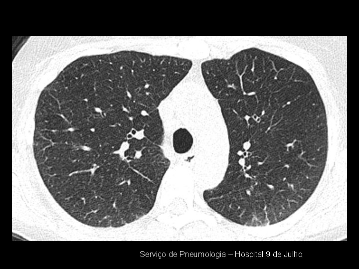 Serviço de Pneumologia – Hospital 9 de Julho 