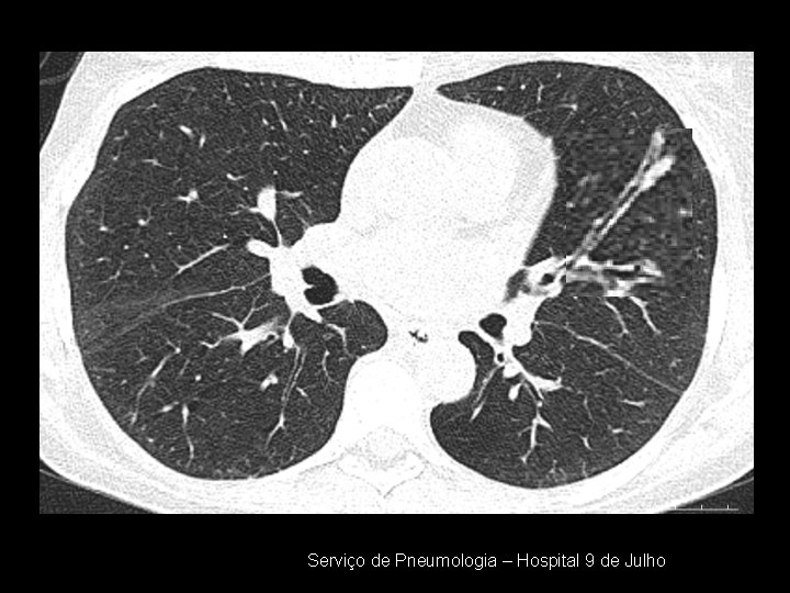 Serviço de Pneumologia – Hospital 9 de Julho 