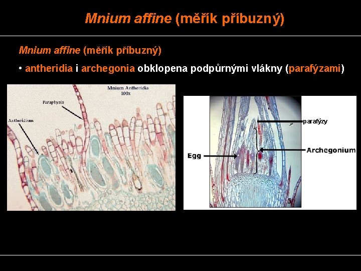 Mnium affine (měřík příbuzný) • antheridia i archegonia obklopena podpůrnými vlákny (parafýzami) parafýzy 