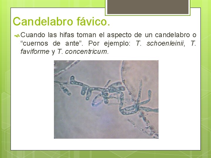 Candelabro fávico. Cuando las hifas toman el aspecto de un candelabro o “cuernos de Candelabro fávico. Cuando las hifas toman el aspecto de un candelabro o “cuernos de