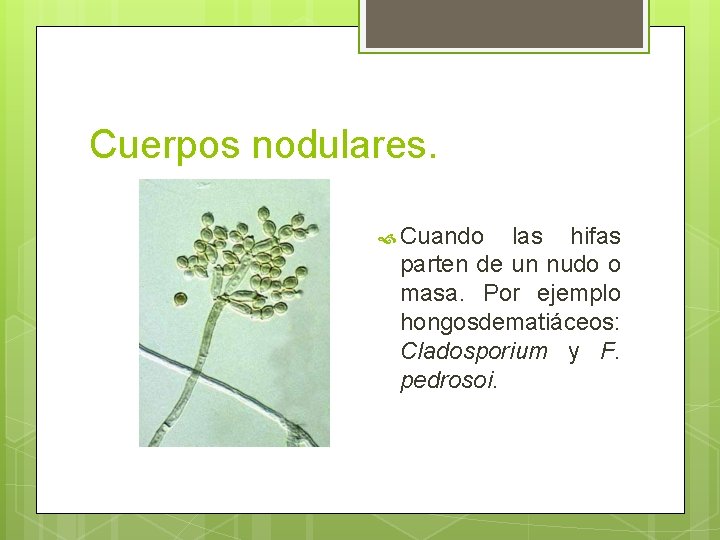 Cuerpos nodulares. Cuando las hifas parten de un nudo o masa. Por ejemplo hongos Cuerpos nodulares. Cuando las hifas parten de un nudo o masa. Por ejemplo hongos