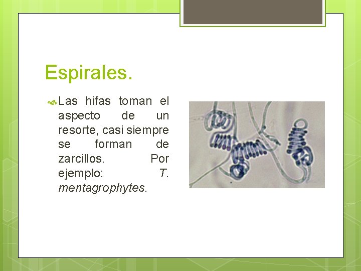 Espirales. Las hifas toman el aspecto de un resorte, casi siempre se forman de Espirales. Las hifas toman el aspecto de un resorte, casi siempre se forman de