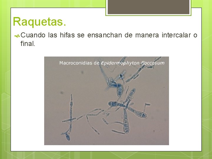 Raquetas. Cuando las hifas se ensanchan de manera intercalar o final. Raquetas. Cuando las hifas se ensanchan de manera intercalar o final.