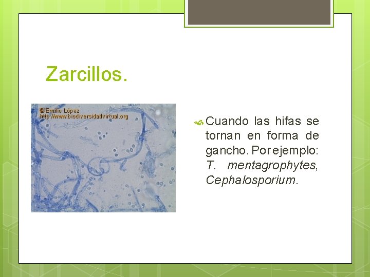Zarcillos. Cuando las hifas se tornan en forma de gancho. Por ejemplo: T. mentagrophytes, Zarcillos. Cuando las hifas se tornan en forma de gancho. Por ejemplo: T. mentagrophytes,