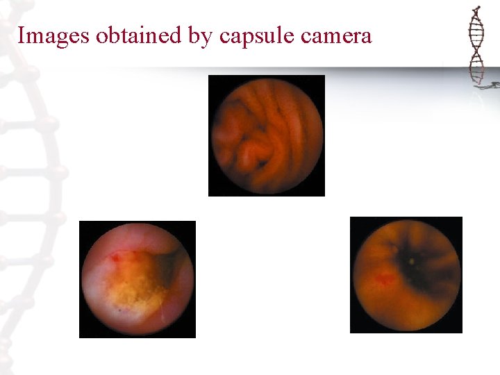 Images obtained by capsule camera 