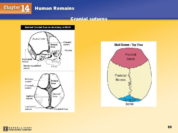Human Remains Cranial sutures 23 