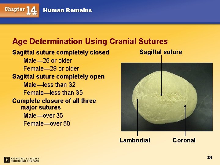 Human Remains Age Determination Using Cranial Sutures Sagittal suture completely closed Male— 26 or
