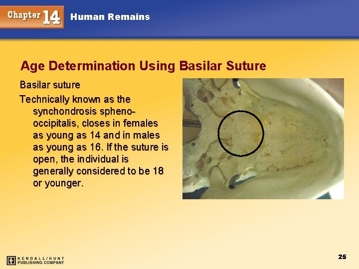 Human Remains Age Determination Using Basilar Suture Basilar suture Technically known as the synchondrosis