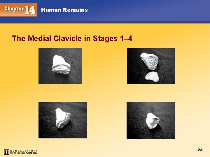 Human Remains The Medial Clavicle in Stages 1– 4 28 