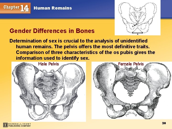 Human Remains Gender Differences in Bones Determination of sex is crucial to the analysis