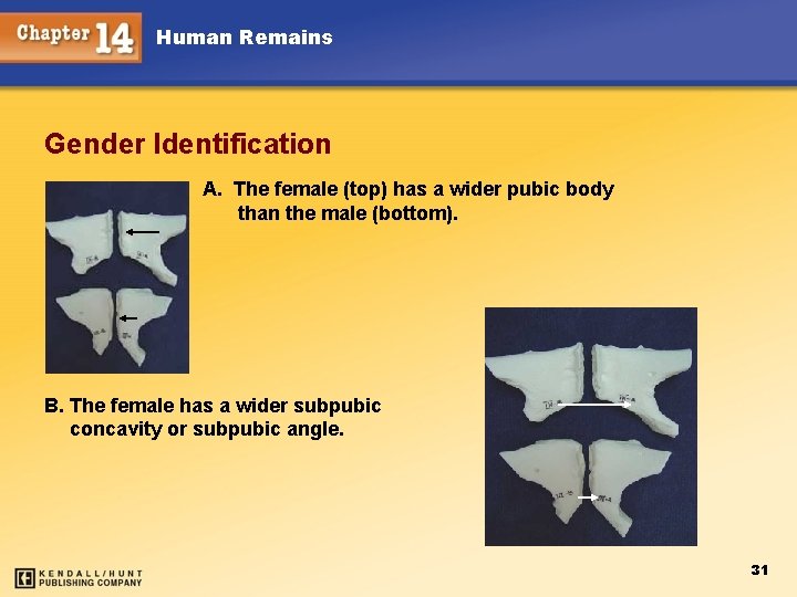 Human Remains Gender Identification A. The female (top) has a wider pubic body than