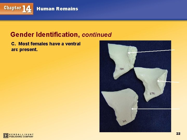 Human Remains Gender Identification, continued C. Most females have a ventral arc present. 32