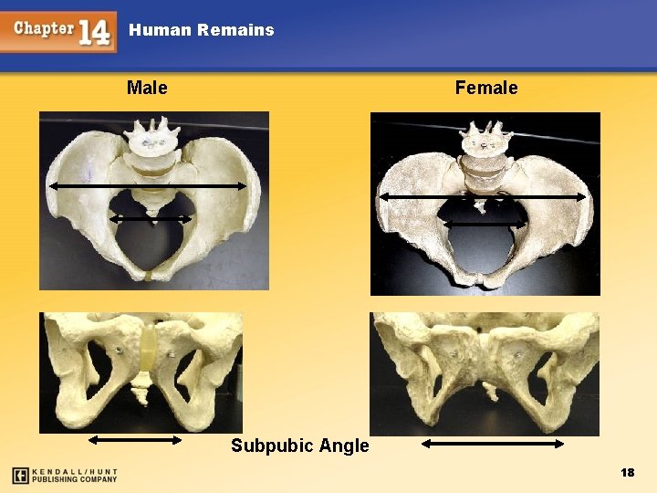 Human Remains Male Female Subpubic Angle 33 18 
