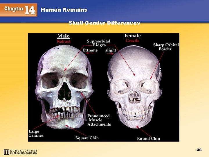 Human Remains Skull Gender Differences 36 