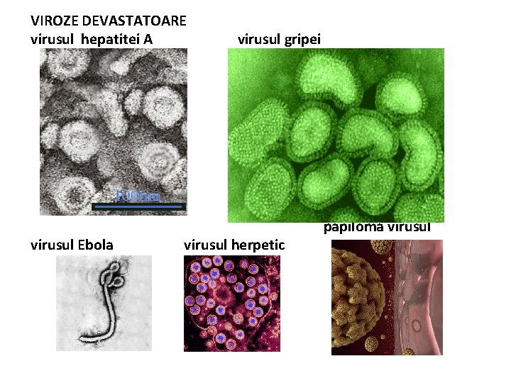 VIROZE DEVASTATOARE virusul hepatitei A virusul Ebola virusul gripei virusul herpetic papiloma virusul 
