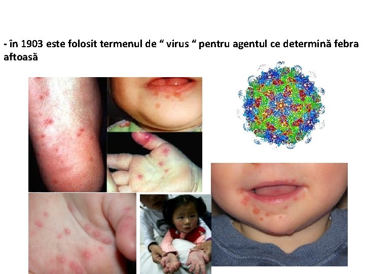 - în 1903 este folosit termenul de “ virus “ pentru agentul ce determină