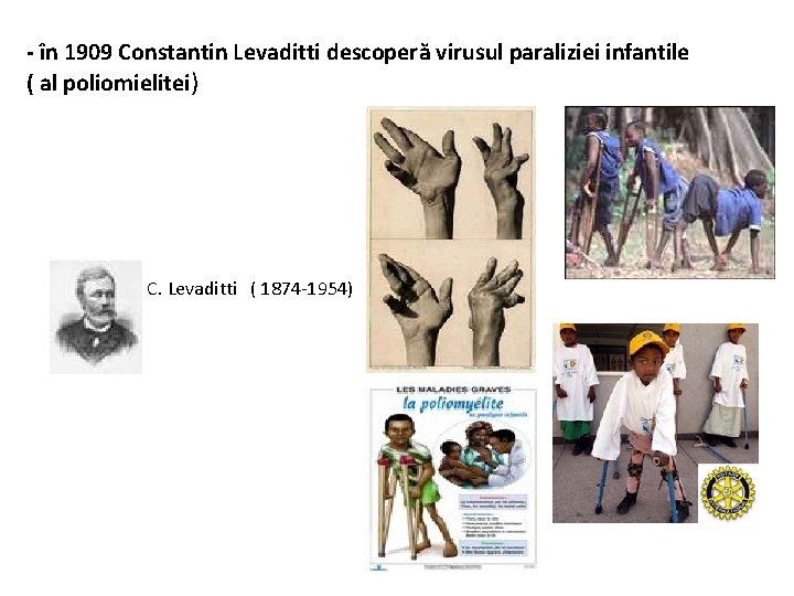 - în 1909 Constantin Levaditti descoperă virusul paraliziei infantile ( al poliomielitei) C. Levaditti