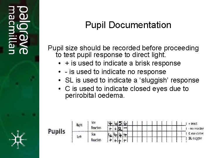 Pupil Documentation Pupil size should be recorded before proceeding to test pupil response to