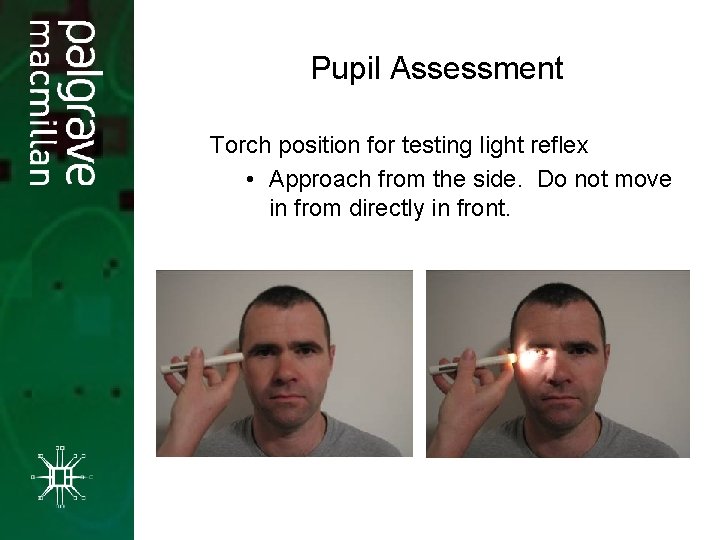 Pupil Assessment Torch position for testing light reflex • Approach from the side. Do