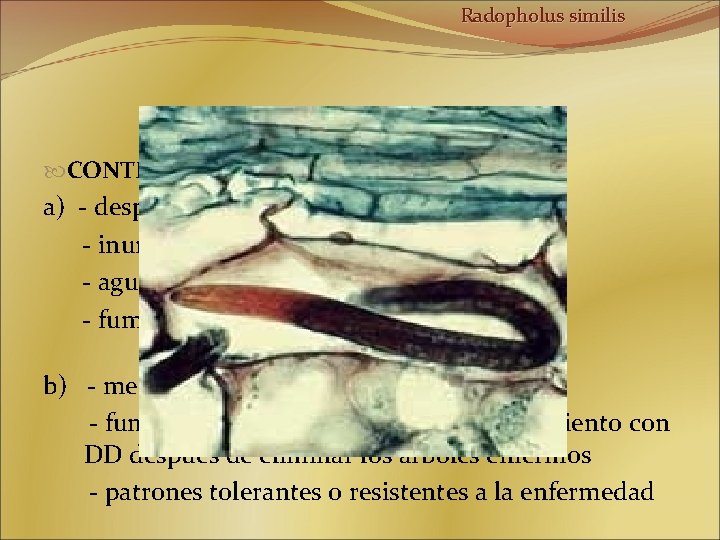 Radopholus similis CONTROL: a) - desprende los tejidos manchados (DBCP) - inundación de los