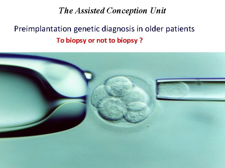 The Assisted Conception Unit Preimplantation genetic diagnosis in older patients To biopsy or not
