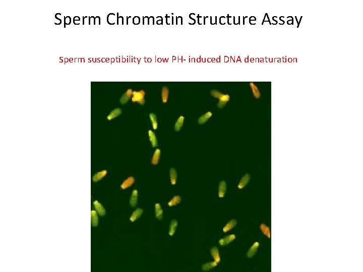 Sperm Chromatin Structure Assay sperm susceptibility to low PH- induced DNA denaturation 