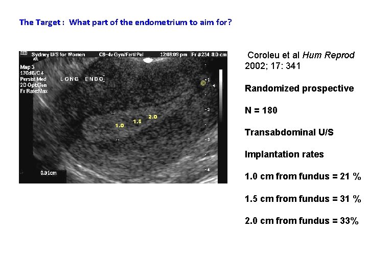 The Target : What part of the endometrium to aim for? Coroleu et al