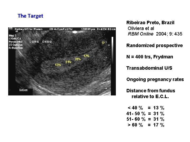 The Target Ribeirao Preto, Brazil Oliviera et al RBM Online 2004; 9: 435 ©