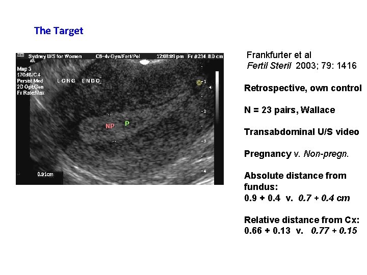 The Target Frankfurter et al Fertil Steril 2003; 79: 1416 © Retrospective, own control