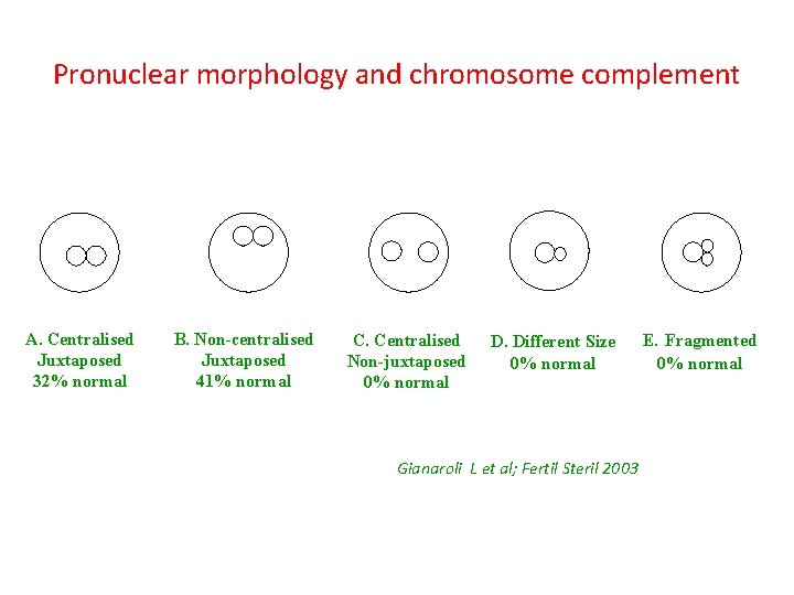 Pronuclear morphology and chromosome complement A. Centralised Juxtaposed 32% normal B. Non-centralised Juxtaposed 41%