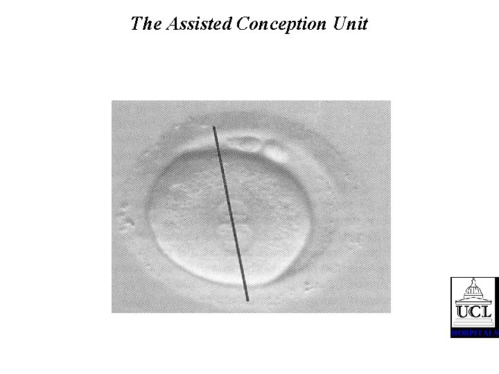 The Assisted Conception Unit 