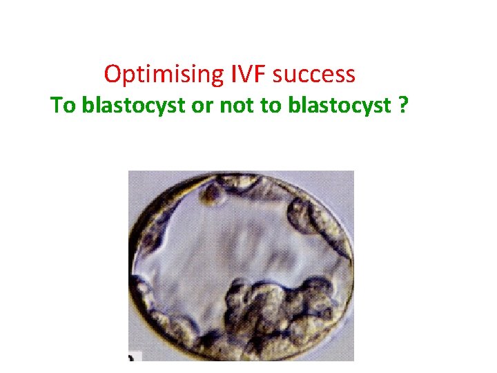 Optimising IVF success To blastocyst or not to blastocyst ? 