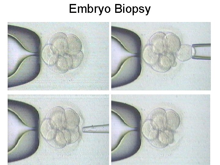 Embryo Biopsy 