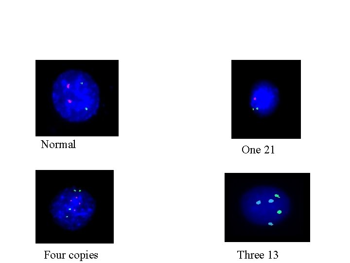 Normal Four copies One 21 Three 13 