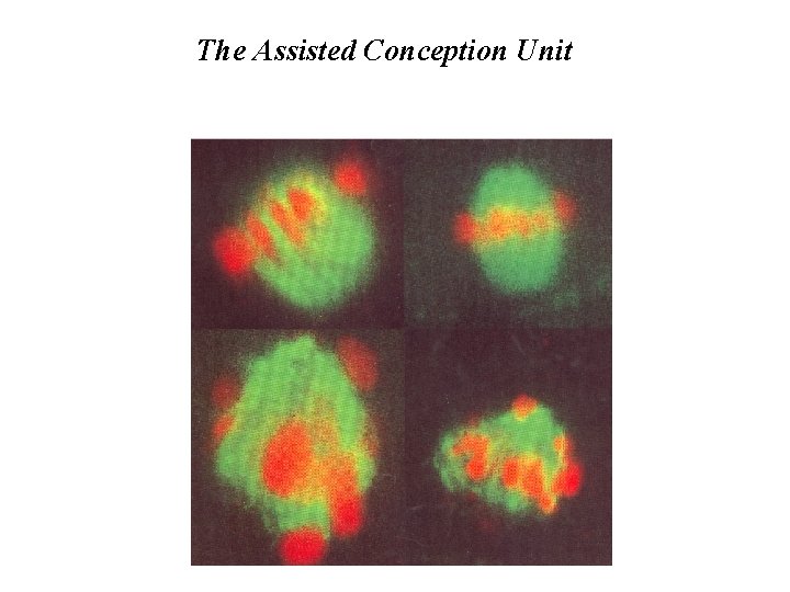 The Assisted Conception Unit 