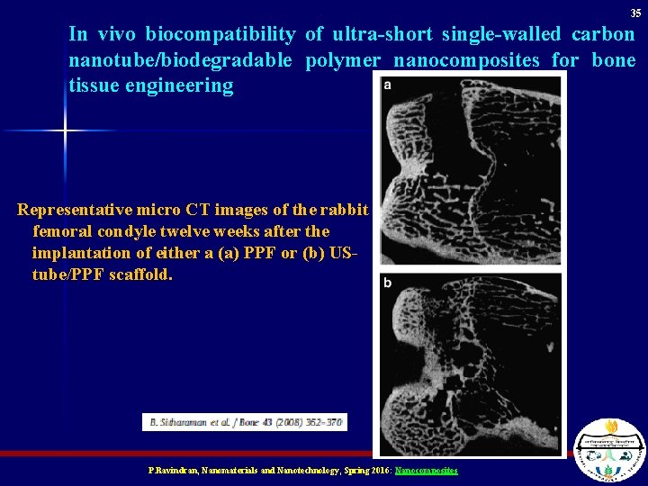 35 In vivo biocompatibility of ultra-short single-walled carbon nanotube/biodegradable polymer nanocomposites for bone tissue