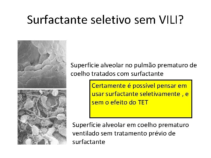 Surfactante seletivo sem VILI? Superfície alveolar no pulmão prematuro de coelho tratados com surfactante